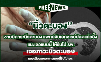 นิ้วตะบอง