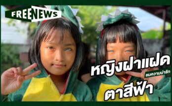 หญิงฝาแฝดตาสีฟ้า