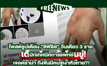 ซิฟิลิส